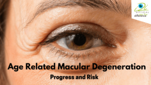 Age Related Macular Degeneration | Eye care clinic in Mauritius | Buy sunglasses