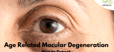 Age related macular degeneration | i2i Optical | best optician in mauritius