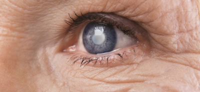 Diabetic Retinopathy | Eye Checkup Center in Mauritius | Optical Store | Eye Care | Eye testing