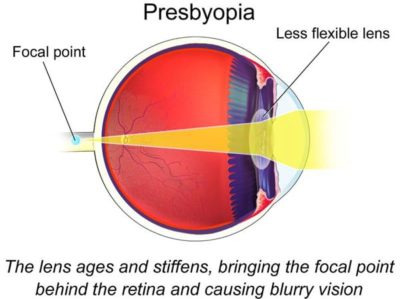 What is Presbyopia ? Detailed study from best optical shop in Mauritius