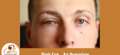 Pink Eye – An Overview